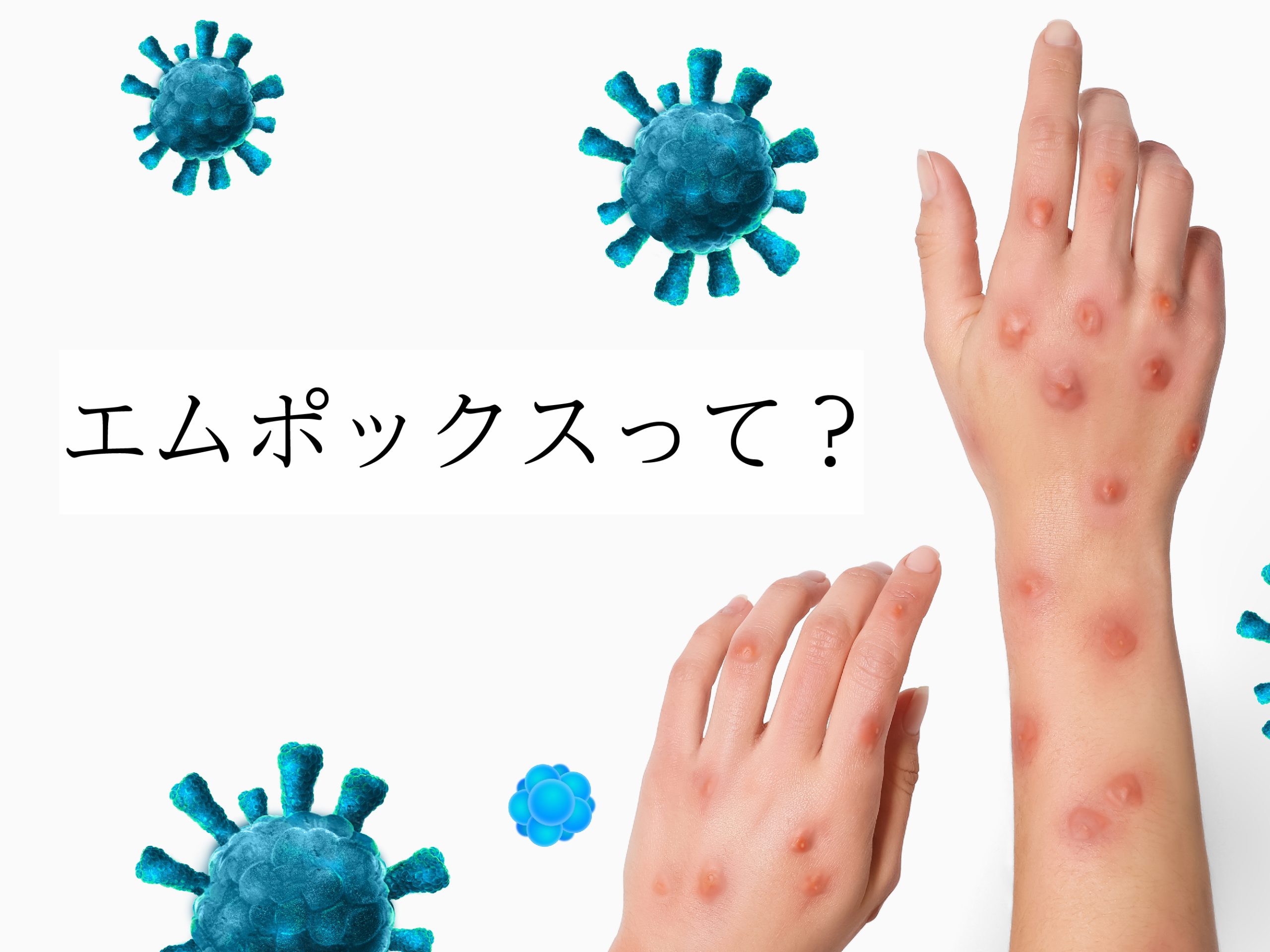 エムポックスって?